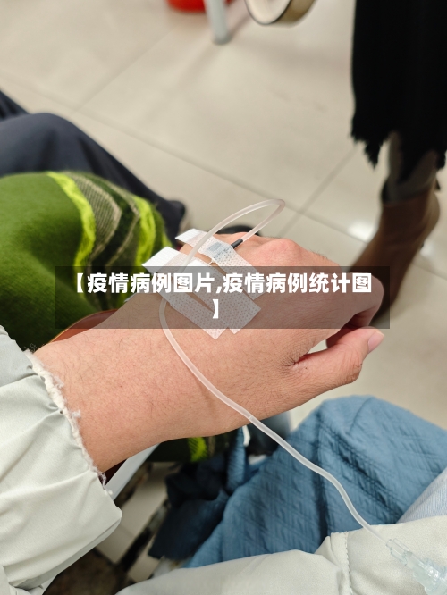 【疫情病例图片,疫情病例统计图】